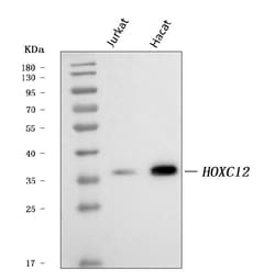 Invitrogen HOXC12 Polyclonal Antibody 100 &mu;g; Unconjugated:Antibodies,