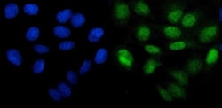 Invitrogen PHF21B Polyclonal Antibody 100 &mu;g; Unconjugated:Antibodies,