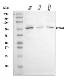 Invitrogen DPY19L1 Polyclonal Antibody 100 &mu;g | Buy Online | Invitrogen&trade; | Fisher Scientific