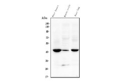 Invitrogen TMEM255B Polyclonal Antibody 100 &mu;g | Buy Online | Invitrogen&trade; | Fisher Scientific