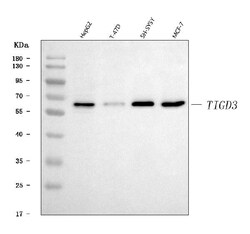 Invitrogen TIGD3 Polyclonal Antibody 100 &mu;g | Buy Online | Invitrogen&trade; | Fisher Scientific