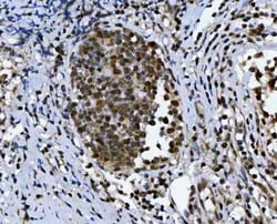 Invitrogen C19orf43 Polyclonal Antibody 100 &mu;g; Unconjugated:Antibodies,