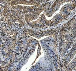Invitrogen C19orf43 Polyclonal Antibody 100 &mu;g; Unconjugated:Antibodies,
