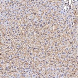 Invitrogen TIMD2 Polyclonal Antibody 100 &mu;g; Unconjugated:Antibodies,