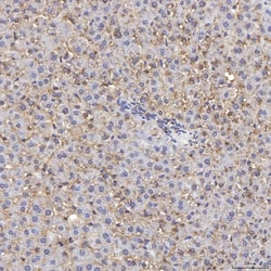Invitrogen TIMD2 Polyclonal Antibody 100 &mu;g; Unconjugated:Antibodies,