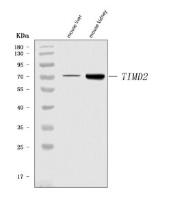 Invitrogen TIMD2 Polyclonal Antibody 100 &mu;g; Unconjugated:Antibodies,