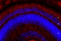 Invitrogen Usherin Polyclonal Antibody 200 &mu;L; Unconjugated:Antibodies,