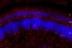 Invitrogen Usherin Polyclonal Antibody 200 &mu;L; Unconjugated:Antibodies,