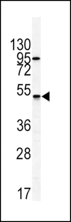 Invitrogen GIPR Polyclonal Antibody 400 &mu;L; Unconjugated:Antibodies,
