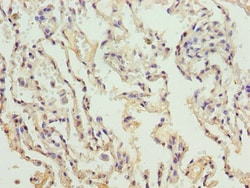 Invitrogen COL4A3 Polyclonal Antibody 100 &mu;g; Unconjugated:Antibodies,