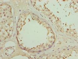 Invitrogen DSCR9 Polyclonal Antibody 100 &mu;g; Unconjugated:Antibodies,