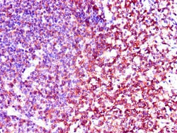 Invitrogen LCK Polyclonal Antibody 100 &mu;g; Unconjugated:Antibodies,