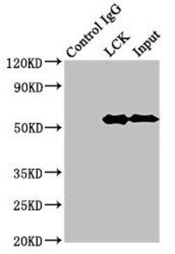 Invitrogen LCK Polyclonal Antibody 100 &mu;g; Unconjugated:Antibodies,