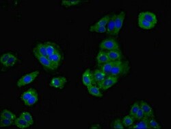 Invitrogen LY6H Polyclonal Antibody 100 &mu;g; Unconjugated:Antibodies,