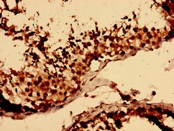 Invitrogen LY6H Polyclonal Antibody 100 &mu;g; Unconjugated:Antibodies,