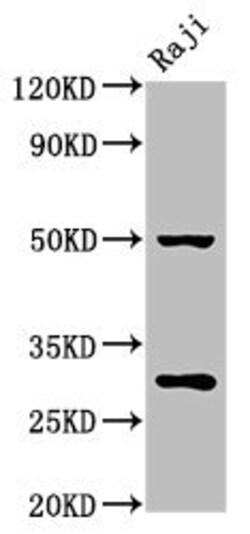 Invitrogen Prohibitin Polyclonal Antibody 100 &mu;g | Buy Online | Invitrogen&trade; | Fisher Scientific