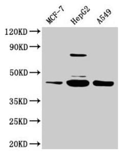 Invitrogen SERPINB1 Polyclonal Antibody 100 &mu;g; Unconjugated:Antibodies,
