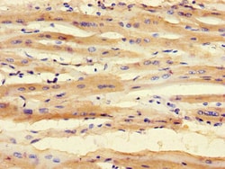 Invitrogen SMNDC1 Polyclonal Antibody 100 &mu;g; Unconjugated:Antibodies,