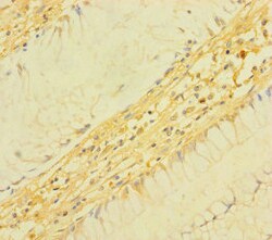 Invitrogen TM4SF5 Polyclonal Antibody 100 &mu;g | Buy Online | Invitrogen&trade; | Fisher Scientific