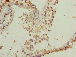 Invitrogen TMEM140 Polyclonal Antibody 100 &mu;g; Unconjugated:Antibodies,