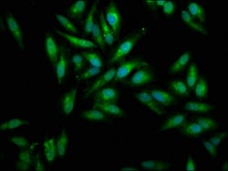Invitrogen Mesothelin Polyclonal Antibody 100 &mu;g; Unconjugated:Antibodies,
