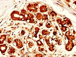 Invitrogen Mesothelin Polyclonal Antibody 100 &mu;g; Unconjugated:Antibodies,