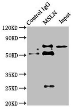 Invitrogen Mesothelin Polyclonal Antibody 100 &mu;g; Unconjugated:Antibodies,