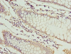 Invitrogen MT1G Polyclonal Antibody 100 &mu;g | Buy Online | Invitrogen&trade; | Fisher Scientific