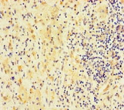 Invitrogen FAM127C Polyclonal Antibody 100 &mu;g | Buy Online | Invitrogen&trade; | Fisher Scientific