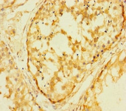 Invitrogen FAM127C Polyclonal Antibody 100 &mu;g | Buy Online | Invitrogen&trade; | Fisher Scientific