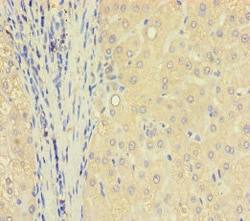 Invitrogen TXNDC8 Polyclonal Antibody 100 &mu;g; Unconjugated:Antibodies,