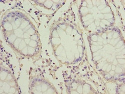 Invitrogen ZNF767P Polyclonal Antibody 100 &mu;g; Unconjugated:Antibodies,