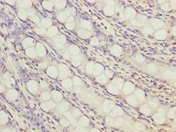 Invitrogen ZNF767P Polyclonal Antibody 100 &mu;g; Unconjugated:Antibodies,