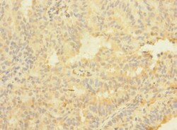 Invitrogen ASTL Polyclonal Antibody 100 &mu;g; Unconjugated:Antibodies,