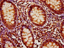 Invitrogen MOB1B Polyclonal Antibody 100 &mu;g; Unconjugated:Antibodies,