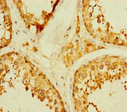 Invitrogen TADA2B Polyclonal Antibody 100 &mu;g; Unconjugated:Antibodies,