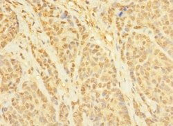 Invitrogen CCDC79 Polyclonal Antibody 100 &mu;g; Unconjugated:Antibodies,