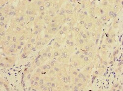 Invitrogen PPM1E Polyclonal Antibody 100 &mu;g; Unconjugated:Antibodies,