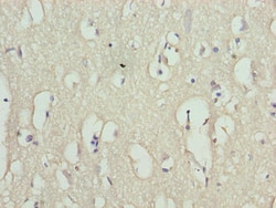 Invitrogen RHPN1-AS1 Polyclonal Antibody 100 &mu;g; Unconjugated:Antibodies,