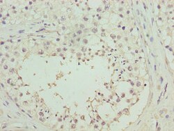 Invitrogen RHPN1-AS1 Polyclonal Antibody 100 &mu;g; Unconjugated:Antibodies,