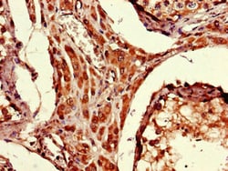 Invitrogen ARRDC1-AS1 Polyclonal Antibody 100 &mu;g; Unconjugated:Antibodies,