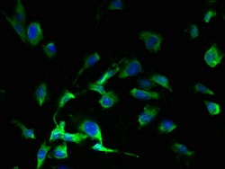 Invitrogen SLC38A7 Polyclonal Antibody 100 &mu;g; Unconjugated:Antibodies,