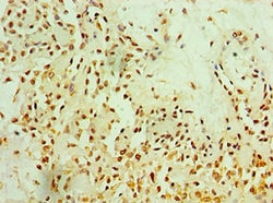 Invitrogen Metadherin Polyclonal Antibody 100 &mu;L | Buy Online | Invitrogen&trade; | Fisher Scientific