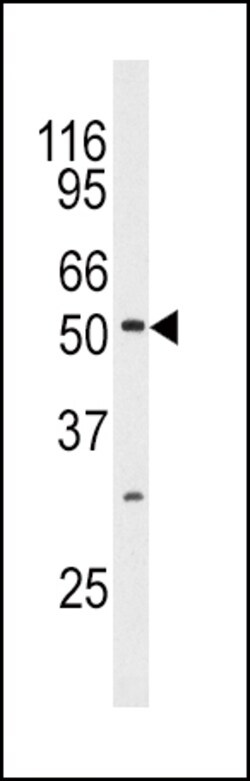 Invitrogen JNK3 Polyclonal Antibody 400 &mu;L | Buy Online | Invitrogen&trade; | Fisher Scientific