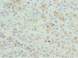 Invitrogen PSME1 Polyclonal Antibody 100 &mu;L; Unconjugated:Antibodies,