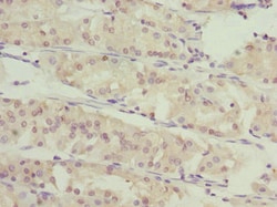 Invitrogen SLC46A1 Polyclonal Antibody 100 &mu;L; Unconjugated:Antibodies,