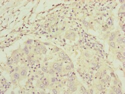 Invitrogen C8A Polyclonal Antibody 100 &mu;L; Unconjugated:Antibodies,
