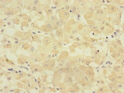 Invitrogen TMPRSS15 Polyclonal Antibody 100 &mu;L | Buy Online | Invitrogen&trade; | Fisher Scientific