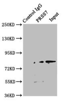 Invitrogen TMPRSS15 Polyclonal Antibody 100 &mu;L | Buy Online | Invitrogen&trade; | Fisher Scientific