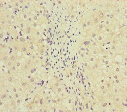 Invitrogen MCCC1 Polyclonal Antibody 100 &mu;L; Unconjugated:Antibodies,